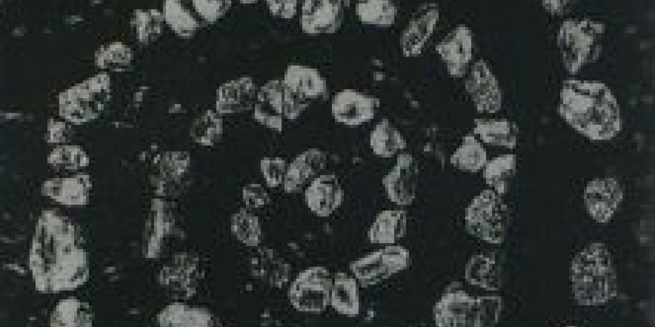 "Jardim Zen II" Isabel Pyrrait, Projecto de Intercâmbio entre Associações